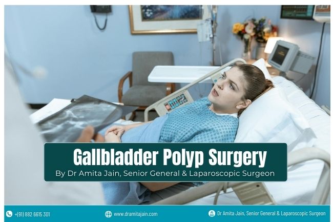 Top Gallbladder Polyp Surgeon in Delhi Dr Amita Jain Top Gallbladder Polyp Surgeon in Delhi Dr Amita Jain